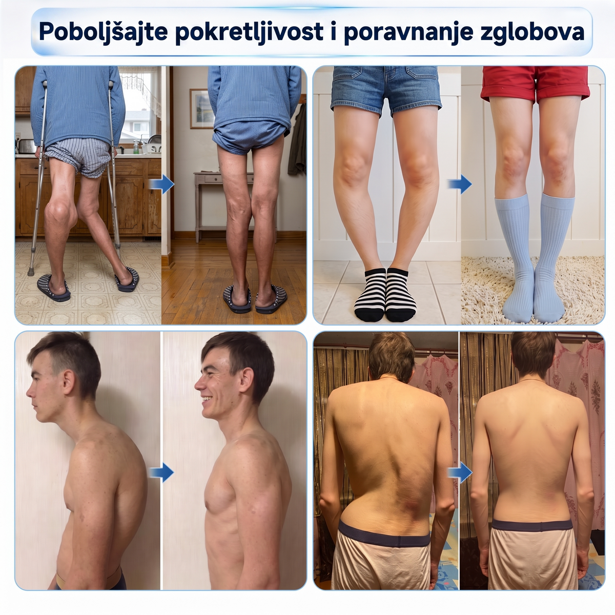 Healrize® 💠 0,05 mm-es mikrotűs roller | Precíz és egyszerű otthoni bőrápolás