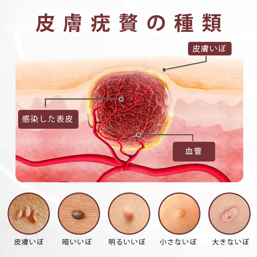 Slim Latte® イボ・シミ集中ケア Proクリーム｜気になる肌悩みに、2週間でなめらかな肌印象へ 🔥