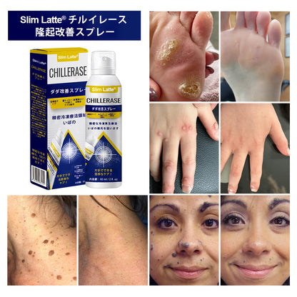 Slim Latte® ChillErase バンプリニューアルスプレー｜冷感クライオケアで、ザラつき・ポツポツ・肌の凹凸をなめらかに🔥🌙