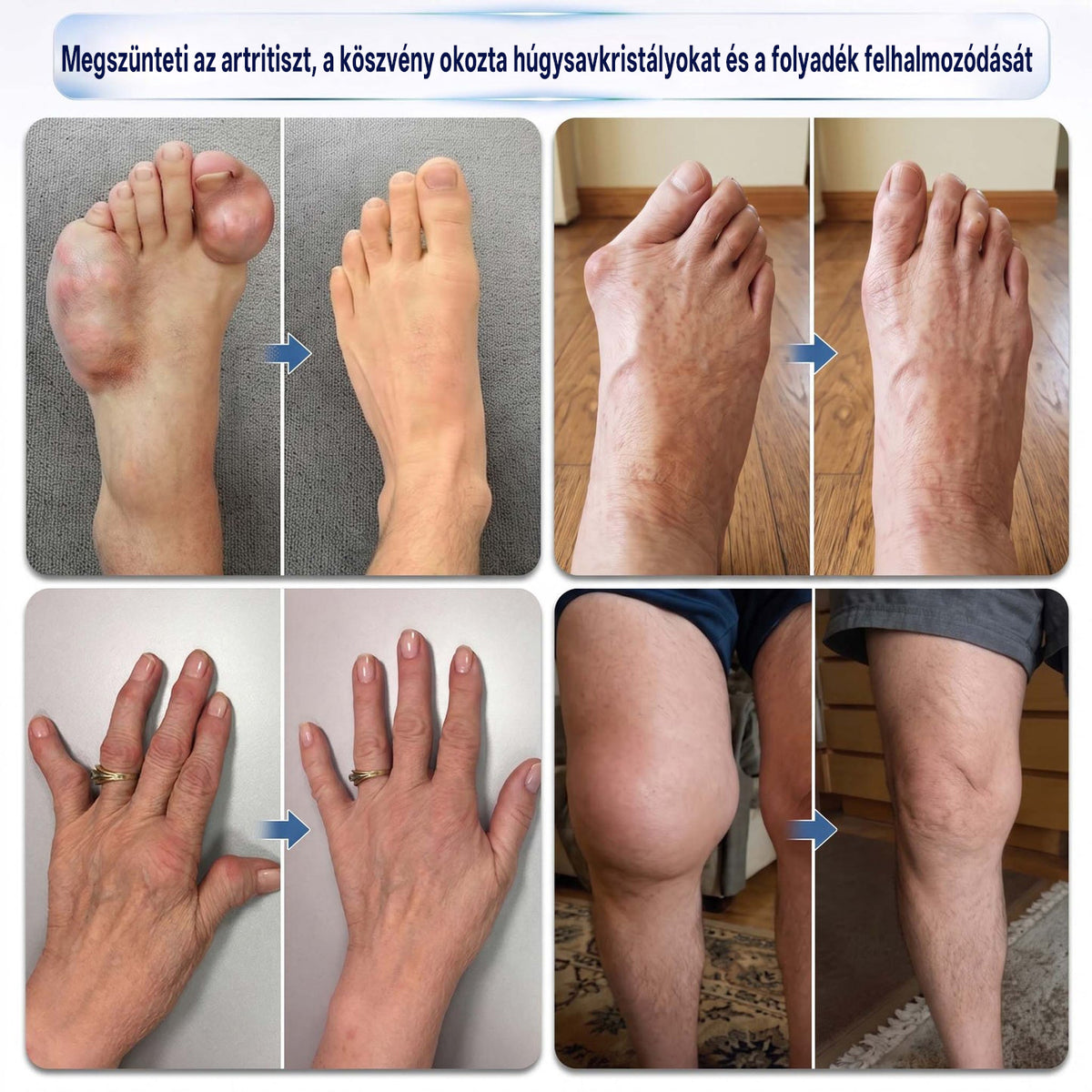 Healrize® 💠 0,05 mm-es mikrotűs roller | Precíz és egyszerű otthoni bőrápolás ❤️