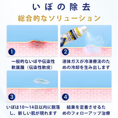 Slim Latte® ChillErase バンプリニューアルスプレー｜冷感クライオケアで、ザラつき・ポツポツ・肌の凹凸をなめらかに🔥🌙