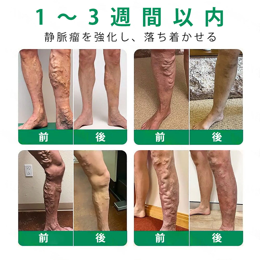 Slim Latte® VeinTarget アルプスハーブ配合 マイクロニードル静脈ケアパッチ 🎁