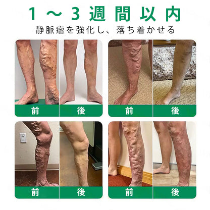 Slim Latte® VeinTarget アルプスハーブ配合 マイクロニードル静脈ケアパッチ 🎁