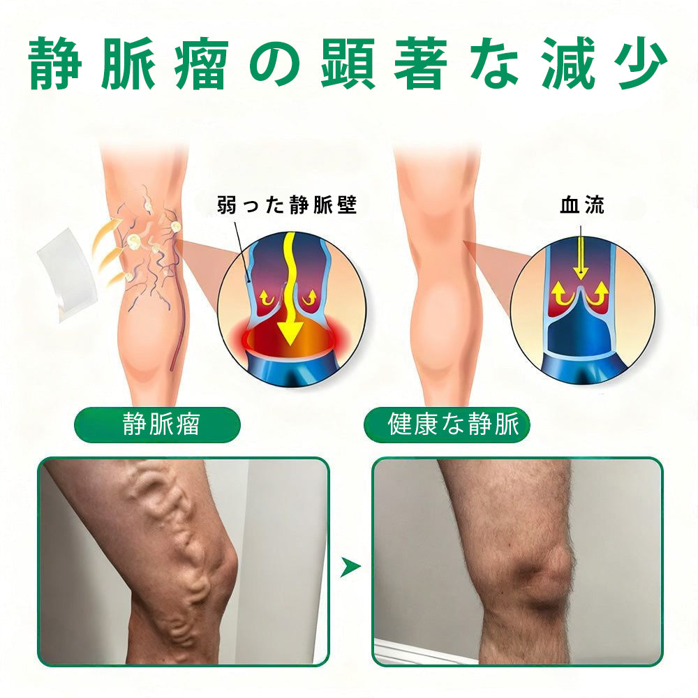 Slim Latte® VeinTarget アルプスハーブ配合 マイクロニードル静脈ケアパッチ 🎁
