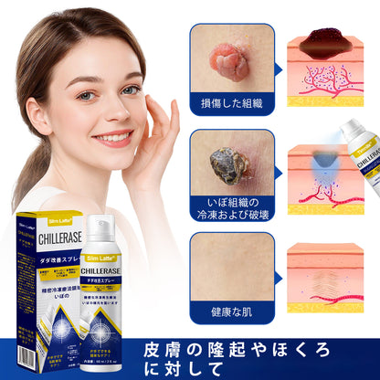 Slim Latte® ChillErase バンプリニューアルスプレー｜冷感クライオケアで、ザラつき・ポツポツ・肌の凹凸をなめらかに🔥🌙